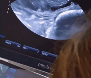 saw two stray puppies by road. One had been hit killed by a…_part2