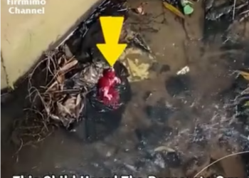 V1901018_#Baby cat trapped in kitten…. #rescuingkitten #love all animals_part2